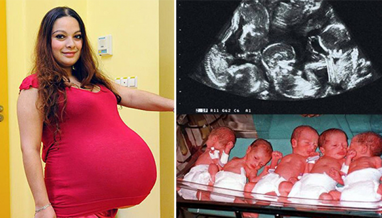 A Czech Mother Is Pregnant With The Countrys First Naturally Conceived